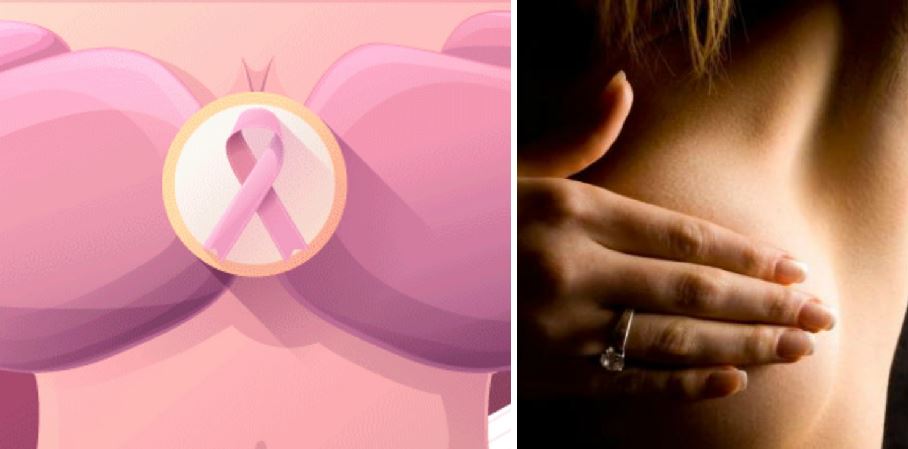 Cómo hacer frente al cáncer de mama