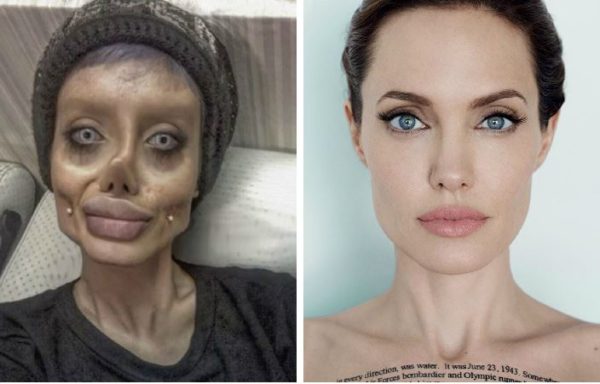 Joven se somete a 50 cirugías para convertirse en Jolie